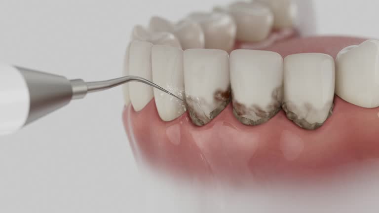 Trusted Teeth Cleaning And Checkup service in Immokalee, FL - Dentist Open Now